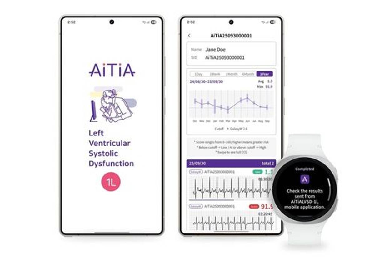 Samsung Unveils World's First Heart Failure Detection Smartwatch